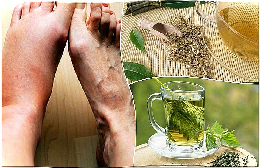 5 home remedies to lower uric acid levels