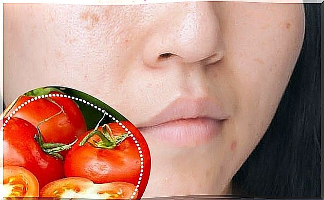 6 natural ingredients to reduce blemishes on the face