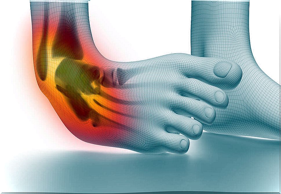 6 tips to prevent and treat ankle sprains