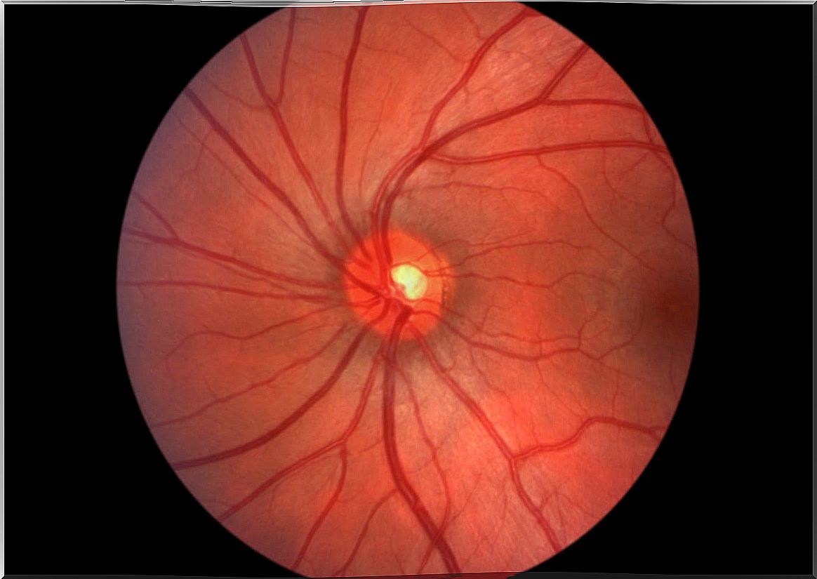 Eye fundus.