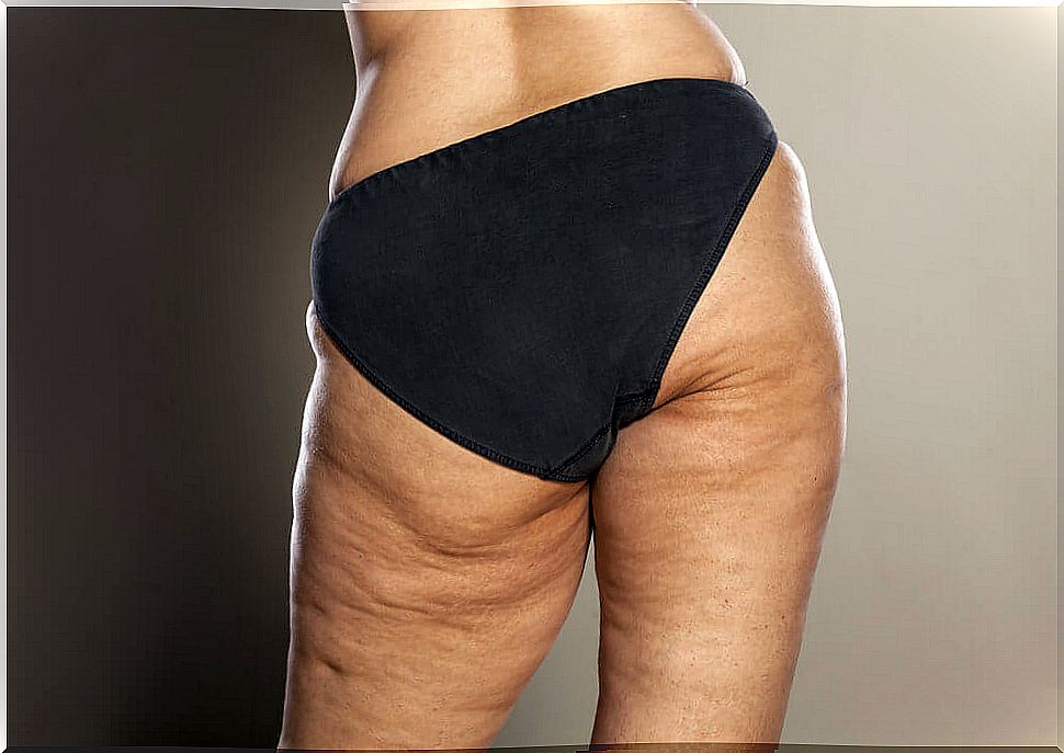 The cellulite diet must be continuous over time to avoid its reappearance.