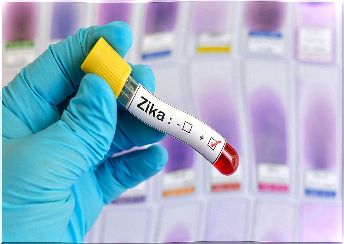 Zika virus test.