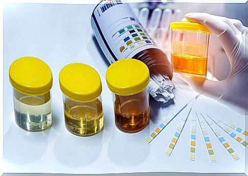 Urine analysis